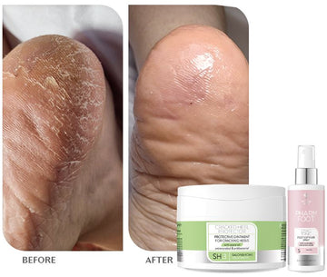 Pharm Foot - Ozone Cracked Heel Protector 75ML Fotkrem