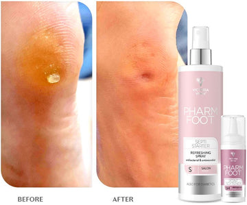 Pharm Foot - Septi Starter – Refreshing Spray 300ml