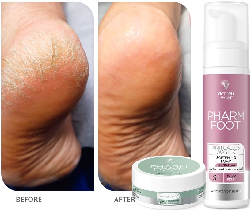 Pharm Foot - Anti Callus Master 200ml