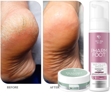 Pharm Foot - Anti Callus Master 200ml